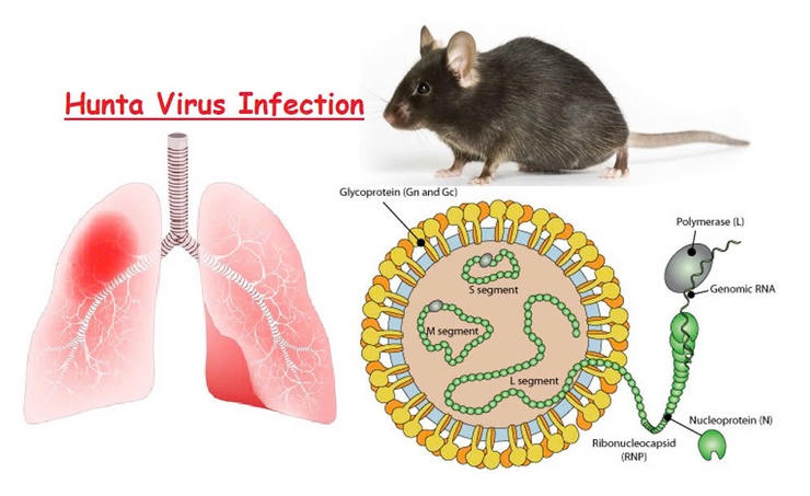 Cảnh báo virus Hanta: Dễ nhầm với cúm nhưng có thể gây suy hô hấp, phù phổi, sốc tim